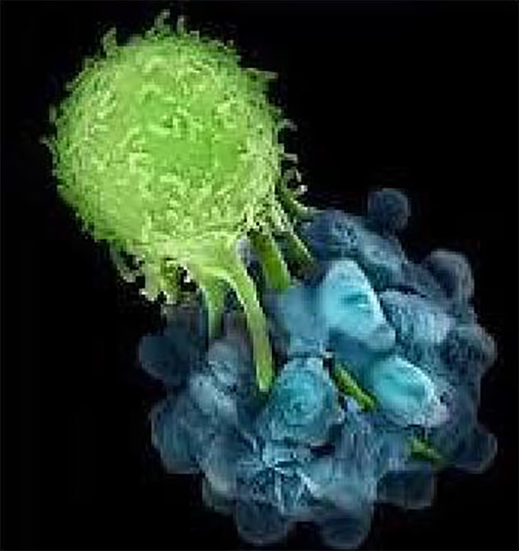 腫瘍細胞を貪食するマクロファージの電子顕微鏡写真イメージ